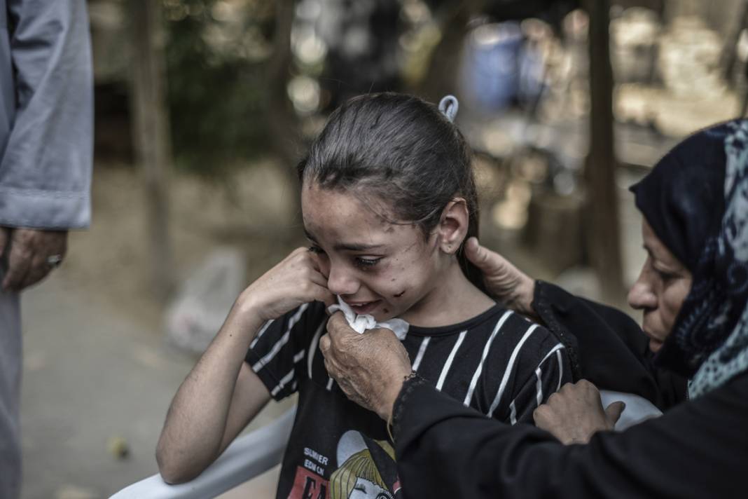 Savaşın yalnız bıraktığı küçük kızın gözyaşları... İsrail tüm ailesini elinden aldı 11
