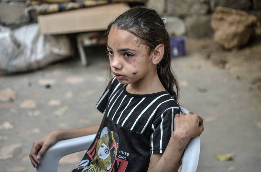 Savaşın yalnız bıraktığı küçük kızın gözyaşları... İsrail tüm ailesini elinden aldı 1