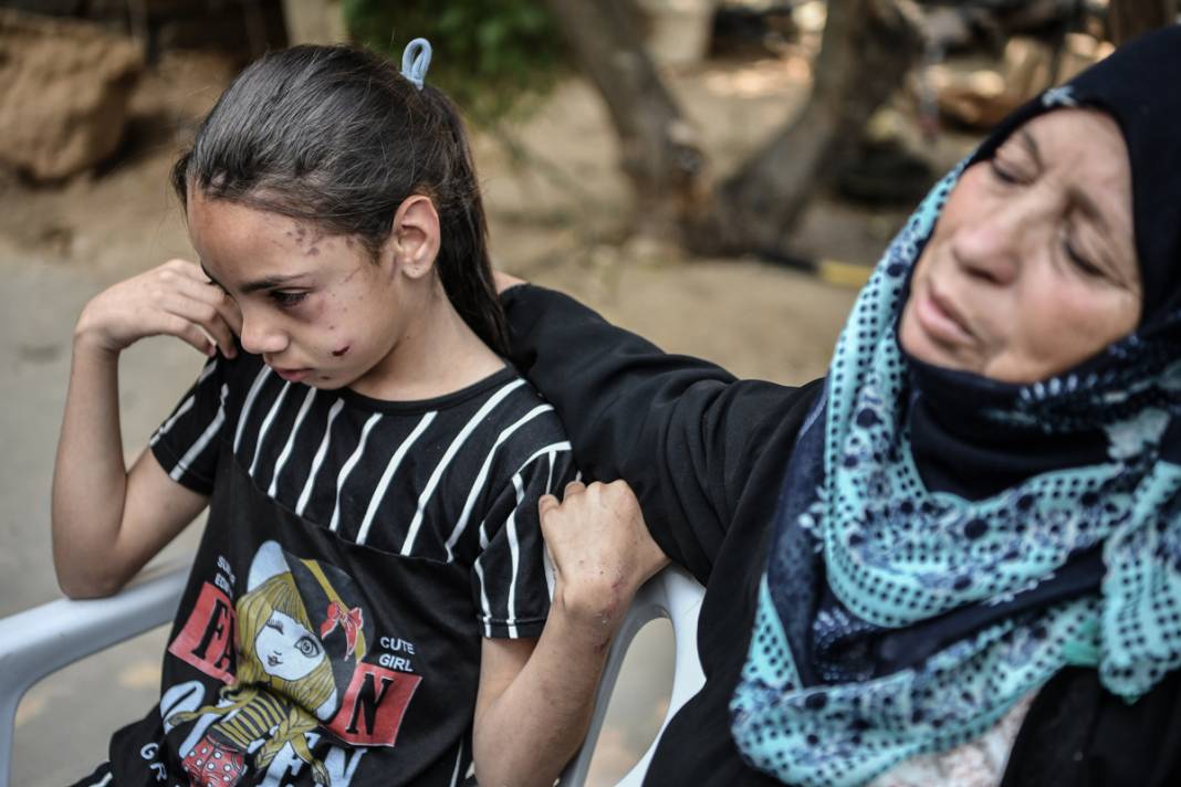 Savaşın yalnız bıraktığı küçük kızın gözyaşları... İsrail tüm ailesini elinden aldı 4