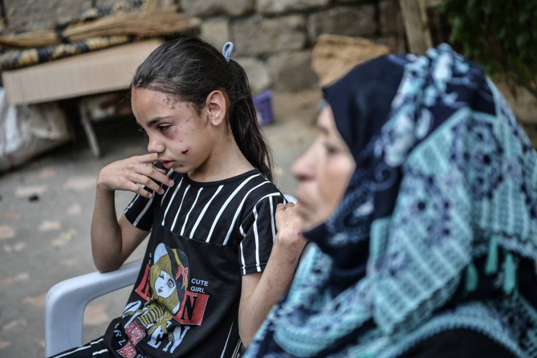 Savaşın yalnız bıraktığı küçük kızın gözyaşları... İsrail tüm ailesini elinden aldı 9
