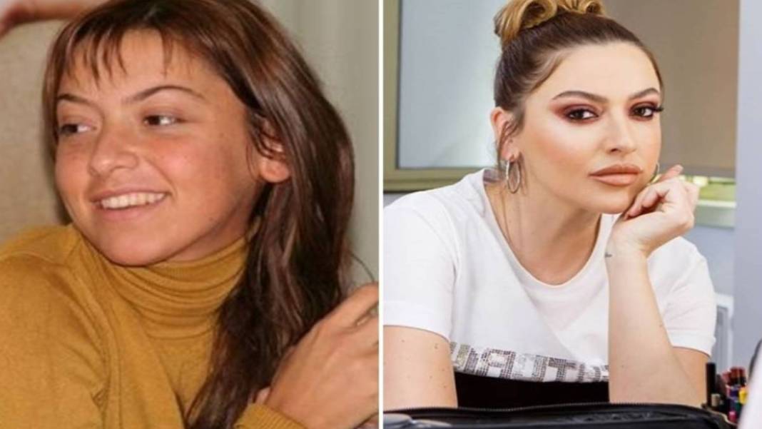 İşte estetikli ünlülerin listesi! Listeyi görünce 'yok artık onda da mı var?' diyeceksiniz 5