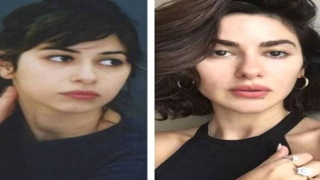 İşte estetikli ünlülerin listesi! Listeyi görünce 'yok artık onda da mı var?' diyeceksiniz 6