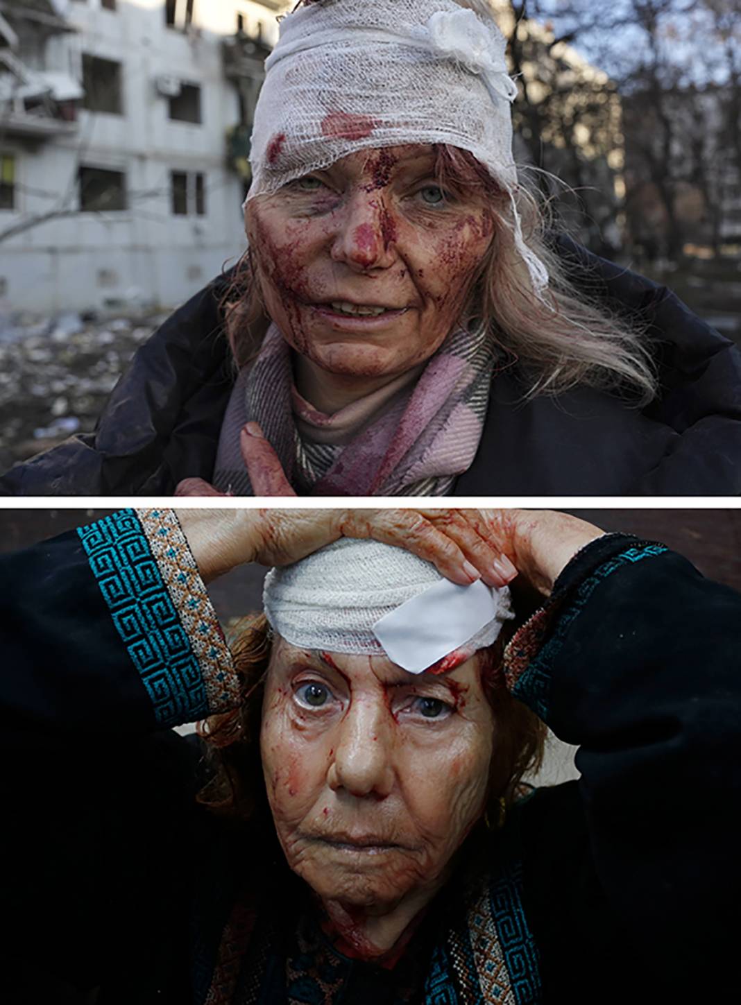 Yerler farklı ama vahşet aynı: Savaşın fotoğrafı değişmiyor 4