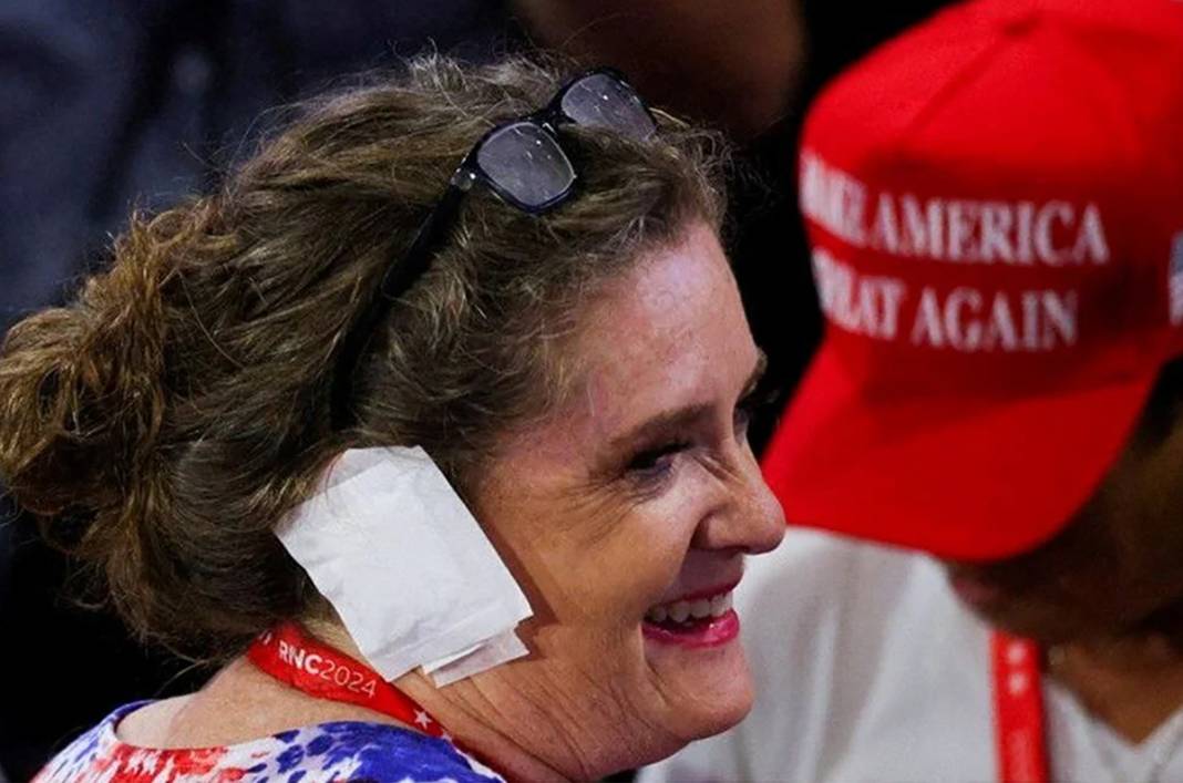 Trump destekçilerinden bandaj akımı 9