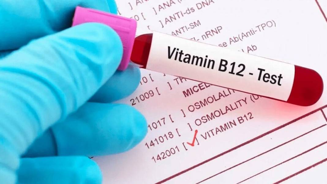 Vücudun gizli hazinesi B12! Karaciğerdeki şaşırtan stok özelliği ortaya çıktı 1