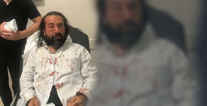 İYİ Parti kurucusu Metin Bozkurt'a saldırıya uğradı MHP MYK üyesi alkışladı