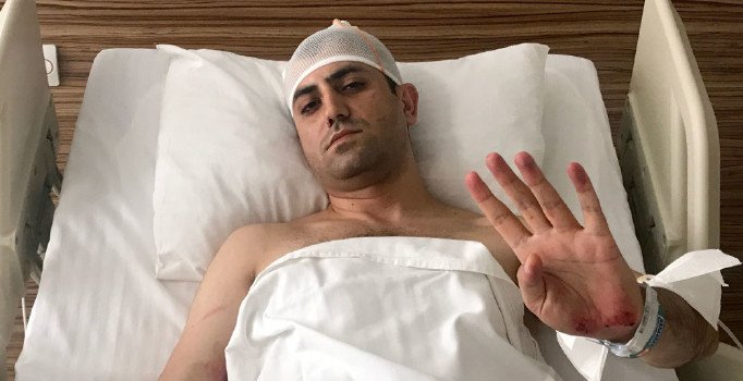 Yeni Akit gazetesi Haber Müdürü Murat Alan'a saldıran 4 kişi serbest