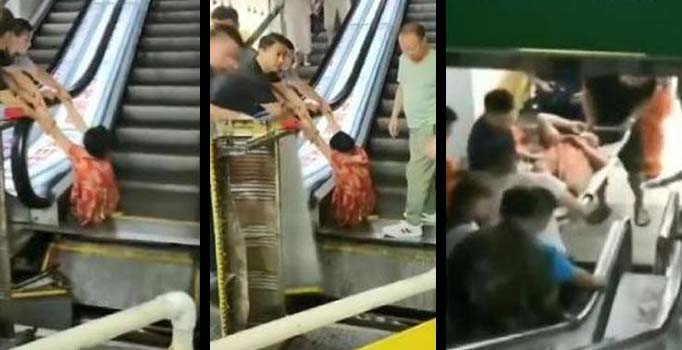 Arızalı yürüyen merdiven bacağını kopardı