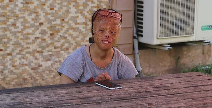 Yüz nakli bekleyen Leyla: Artık bir mucize olsun istiyorum