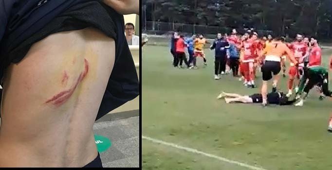 Hazırlık maçı öncesinde büyük kavga