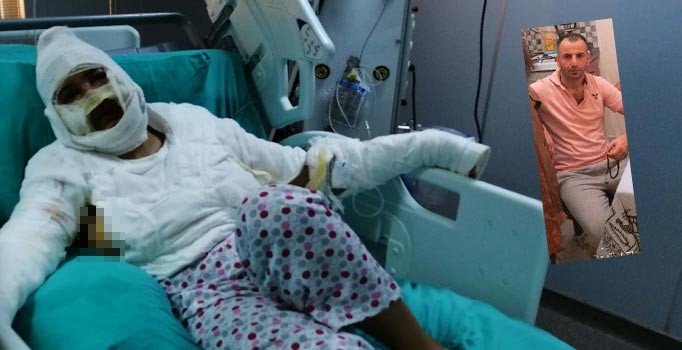 Cezaevinden izinli çıktı, eski eşini önce bıçakladı sonra yağ ile yaktı