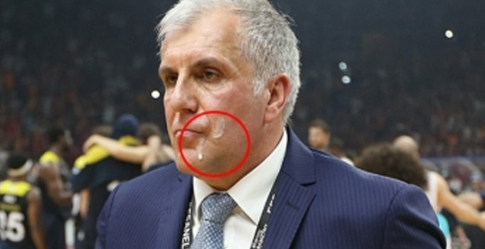 Obradovic: Evet yüzüme tükürdüler