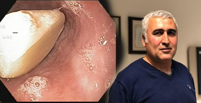 "Çiğnemeden sarımsak yut" tavsiyesi canından ediyordu