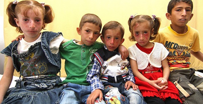 Suriyeli 6 kuzen aynı hastalıktan ölümün eşiğinde