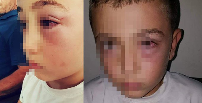 Oğlunun üzerine su atan çocuğu döven zanlı gözaltına alındı