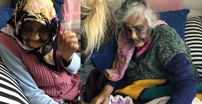 Yazıklar olsun! Bakıcısı yaşlı kadını bu hale getirdi