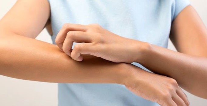 Uzmanlar uyardı ‘uyuz vakası arttı’