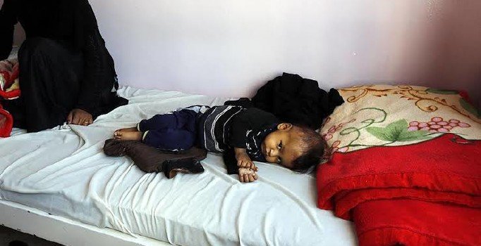 Hudeyde'yi salgın hastalık vurdu, 60 kişi öldü