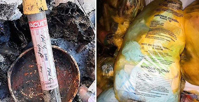 Rusya'da HIV virüsü alarmı