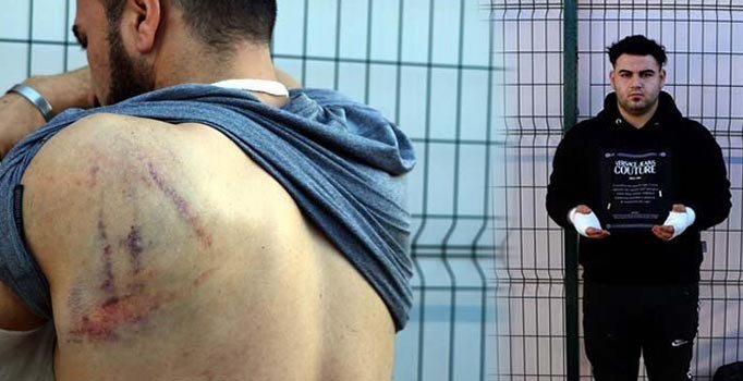 Yunanlıların darp edip gönderdiği mülteciler konuştu: Ellerimi bıçakla kestiler