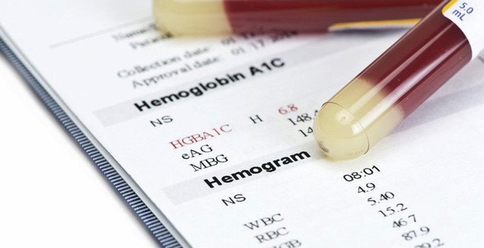 HGB nedir? HGB düşüklüğü ve yüksekliği anlamı