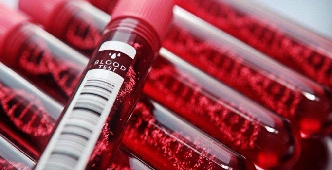 AST nedir? AST düşüklüğü ve yüksekliği ne anlama gelir?