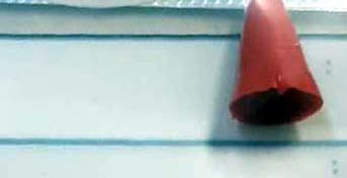 Son dakika! Mert'in ölümüne neden olan şırınga kapağı otopside çıkarıldı