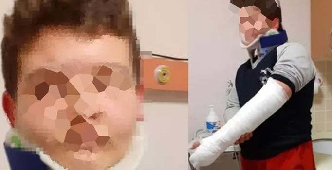 12 yaşındaki çocuklarını döve döve sokağa attılar!