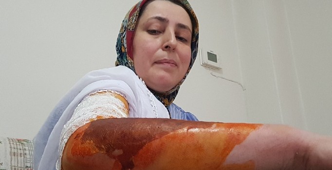 Eşini kaynar su ile haşlayan adama 1 ay evden uzaklaştırma cezası