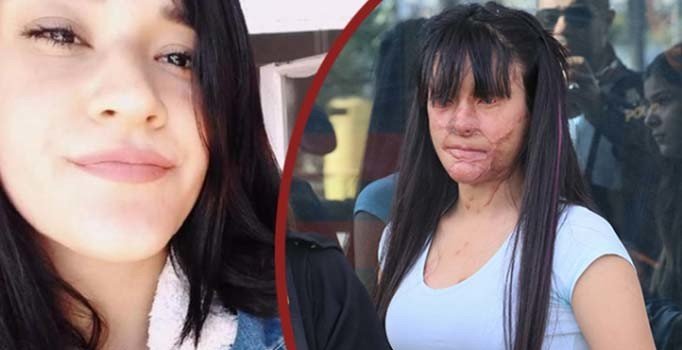 Berfin'e asitle saldıran sanığa 13 yıl hapis