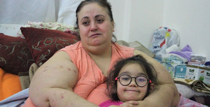 220 kiloluk kadının 'beni kurtarın' feryadı