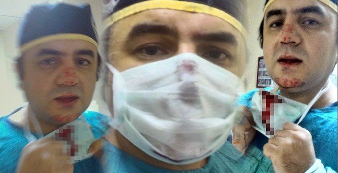 Sağlık Bakanı Fahrettin Koca'dan darp edilmesine rağmen doğuma giren doktor hakkında açıklama