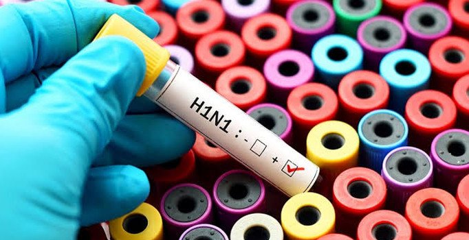 Ordu’daki ölümün domuz gribinden olduğu kesinleşti