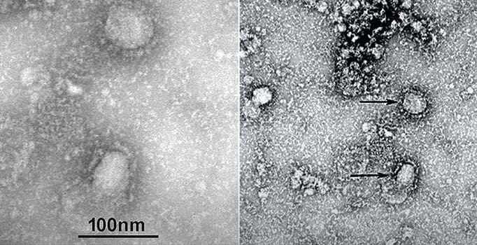 Koronavirüsten korunmak için 6 önemli adım