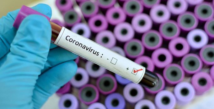 İstanbul Üniversitesi-Cerrahpa?a'dan Korona virüs bilgilendirme raporu