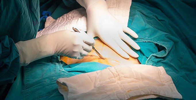 Rusya’da doktorlar doğum sırasında bebeğin yüzünü neşterle kesti