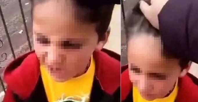 Saç tıraşı olmayan 6 yaşındaki öğrencisine şiddet uyguladı