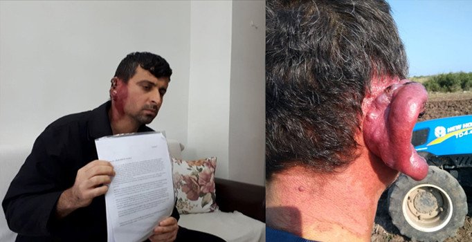 Kulağını saran tümörden kurtulmak istiyor