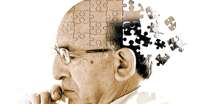 Alzheimer’ı 10 yıl  önceden bilen test