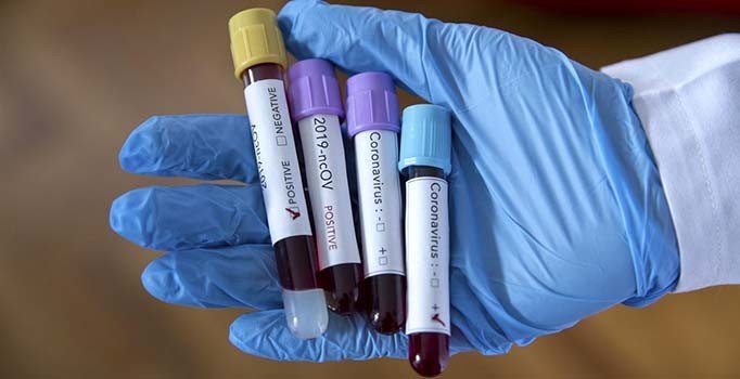 İran'da 2 kişide yeni tip corona virüs tespit edildi