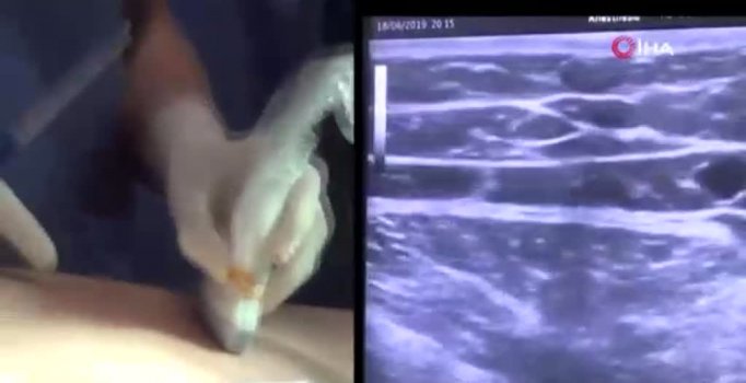 Japonya’da Türkiye’nin milli tıbbi cihazları kullanılıyor