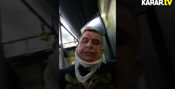 Sabiha Gökçen'deki kazada utandıran görüntü