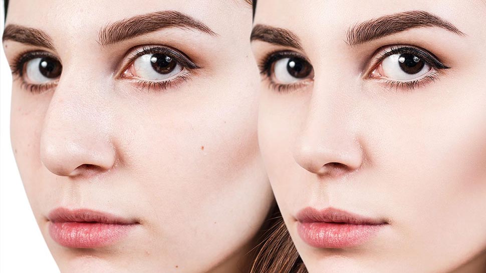 Estetik ameliyatlarında mağdur olmamak için bunlara dikkat