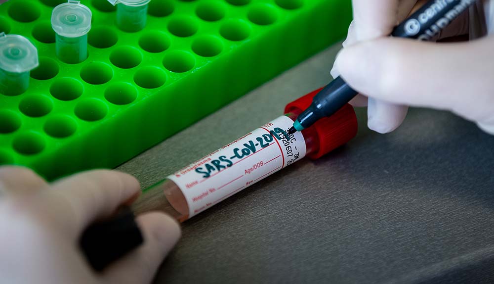 Koronovirüs kronik hastaları da vurdu: Kontrol randevularını erteledik