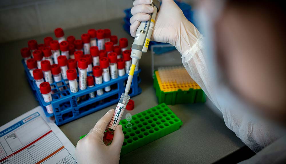 Koronavirüsün 2 yeni belirtisi daha ortaya çıktı: Nörolojik semptomlar saptandı