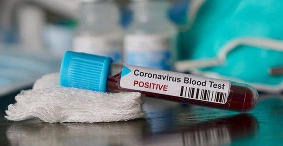 Filyasyon nedir? Corona virüs vakalarında kullanılan filyasyon ne demek?