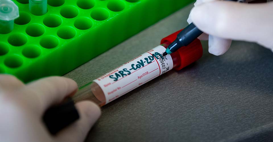 Kovid-19'un ilk kez detaylı ve yüksek çözünürlüklü görüntüleri paylaşıldı