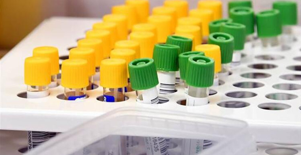 Ermenistan’da koronavirüs vaka sayıları yükselişe geçti