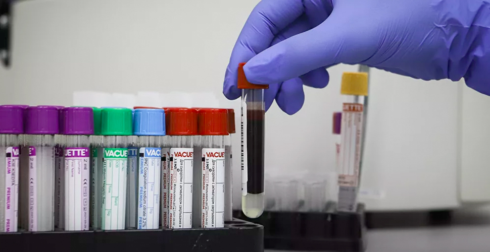 Tahran'da yapılan koronavirüs taraması test kiti yetersizliği nedeniyle durduruldu