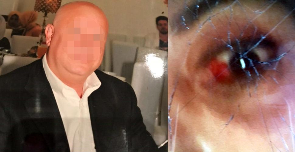 31 yildir esinden siddet goren kadinin yardim cigligi oldurulmekten korkuyorum 31 yildir esinden siddet goren kadinin yardim cigligi oldurulmekten korkuyorum
